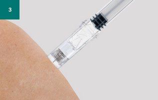 Insertion of the cannula of the safety syringe Insertion of the cannula of the safety syringe